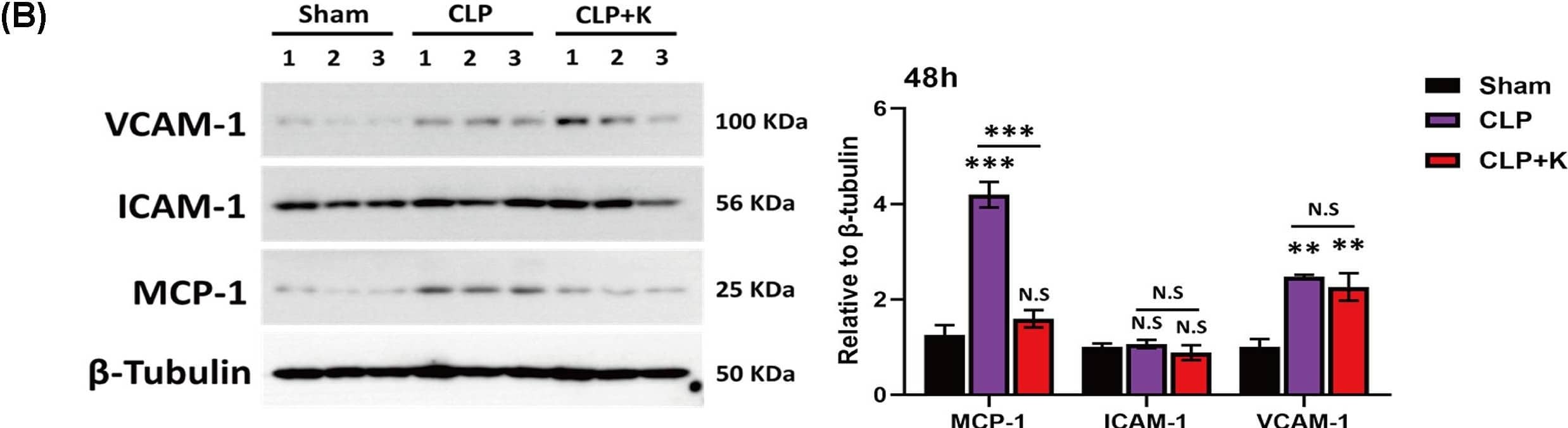 The production of MCP-1, VCAM-1, and ICAM-1 was significantly inhibited in Kaempferol treatment during sepsis(A) The protein expression level of MCP-1, VCAM-1, and ICAM-1 at 24 h; (B) protein expression level of MCP-1, VCAM-1, and ICAM-1 at 48 h in sham, saline-treated CLP mice, and kaempferol treated CLP mice (n = 3 per group, mean +/- S.E.M, *P<0.05, **P<0.01, ***P<0.001). Image collected and cropped by CiteAb from the following open publication (//pubmed.ncbi.nlm.nih.gov/37440431), licensed under a CC-BY license. Not internally tested by Novus Biologicals.