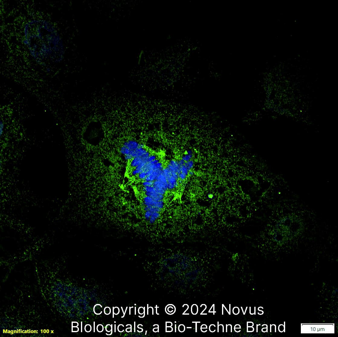Aurora A (1F8) was detected in immersion fixed Caco-2 human colorectal adenocarcinoma cell line using Mouse anti-Aurora A (1F8) Protein G Purified Monoclonal Antibody conjugated to Alexa Fluor® 488 (Catalog # NBP2-22118AF488) (green) at 10 µg/mL overnight at 4C. Cells were counterstained with DAPI (dark blue). Cells were imaged using a 100X objective and digitally deconvolved.