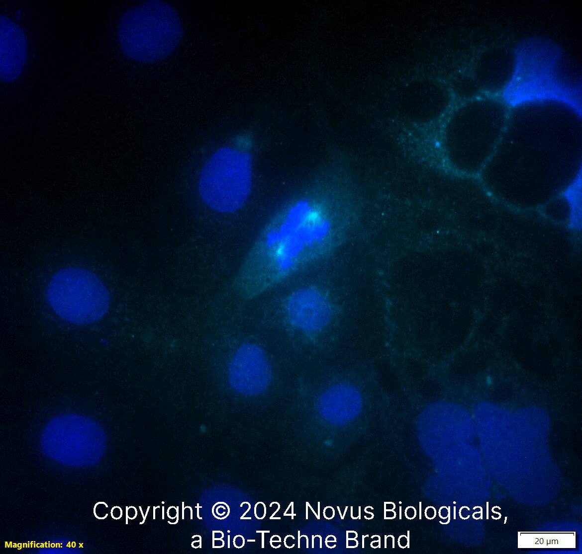 Aurora A (1F8) was detected in immersion fixed Caco-2 human colorectal adenocarcinoma cell line using Mouse anti-Aurora A (1F8) Protein G Purified Monoclonal Antibody conjugated to Alexa Fluor® 647 (Catalog # NBP2-22118AF647) (light blue) at 10 µg/mL overnight at 4C. Cells were counterstained with DAPI (dark blue). Cells were imaged using a 40X objective.