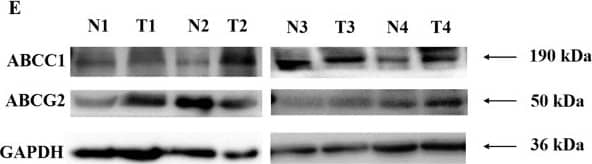 (A–D) Gene expression of drug transporters in breast cancer patients (A) ABCC1, (B) ABCG2 in local cohort (C) ABCC1, (D) ABCG2 in TCGA cohort and (E–G) Protein expression of drug transporters (E) Representative blots in adjacent normal (N) and tumor (T) tissues, (F) Densitometric analysis of ABCG2 and (G) ABCC1 levels in adjacent normal and tumor tissues. Image collected and cropped by CiteAb from the following open publication (//pubmed.ncbi.nlm.nih.gov/36309544), licensed under a CC-BY license. Not internally tested by Novus Biologicals.