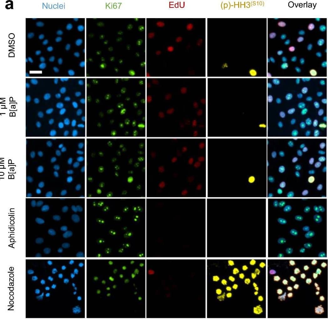 Simple Western: Glucose 6 Phosphate Dehydrogenase Antibody (2H7) - BSA Free [NBP2-22125] - B[a]P-Induced Changes in Cell Cycle. (a) Beas-2B cells treated with 1 µM or 10 µM B[a]P (24 h), 3 µg/mL aphidicolin (18 h), & 100 ng/mL nocodazole (18 h) were prepared for cell imaging post-treatment & immunofluorescent staining. A reference cell cycle diagram is shown. The categorization schematic applied to immunofluorescent images is presented as well as a reference diagram of mammalian cell cycle. Scale bar = 25 μm. (b) Beas-2B cells treated with B[a]P were assessed for WST1 metabolism. n = 5. (c) Quantitative EdU uptake among EdU + Beas-2B cells treated with B[a]P. n = 4. (d) Cumulative cell cycle phase distributions of Beas-2B cells treated with B[a]P or cell cycle controls are presented. n = 4, except nocodazole-treated Beas-2B for which n = 2. (e) Magnitude changes compared to untreated controls among each categorical cell cycle phase are presented; bar colors coincide with phase designations presented in (d). n = 4, except nocodazole-treated Beas-2B for which n = 2. Positive changes denote increased percentage of cells in a specific phase among treated cells, whilst negative values denote decreased percentage. Endpoints are the arithmetic mean of listed independent experiments with error bars denoting one standard error of the mean. Image collected & cropped by CiteAb from the following publication (//pubmed.ncbi.nlm.nih.gov/37217524), licensed under a CC-BY license. Not internally tested by Novus Biologicals.