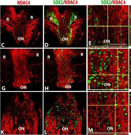 HDAC4 localization pattern in developing murine optic nerve. (A) Low magnification confocal micrograph showing the P30 optic nerve (ON), optic nerve head and retina (R) double-labeled for SOX2 (green) and HDAC4 (red). Optic nerve sections at E16 (B-E), P5 (F-I) and P30 (J-M) were triple-labeled with DAPI (blue), SOX2 (green) and HDAC4 (red). (B, F, J). Overlays of SOX2 and DAPI to aid in orientation of the image. Subsequent panels did not include DAPI to better show the co-localization of the SOX2 and HDAC3 labels. (C, G, K) HDAC4; (D, H, L) double-label of SOX2 and HDAC4. Composite images in E, I and M show z stacks of optic nerve at high magnification; horizontal yellow lines correspond the x axis plane and vertical yellow lines corresponds to the y axis. The x, z axis is shown at the bottom of each panel, while the y, z axis is shown to the right of the panel. Negative controls at each stage showed a lack of immunoreactivity following preabsorption of antibodies with the peptide immunogen (N-P). Abbreviations: R; retina, ON; optic nerve. Scale bars = 50 μm. Scale bar in B applies to B-D, F-H, and J-L. Scale bar in E applies E, I and M. Image collected and cropped by CiteAb from the following open publication (//pubmed.ncbi.nlm.nih.gov/25011550), licensed under a CC-BY license. Not internally tested by Novus Biologicals.
