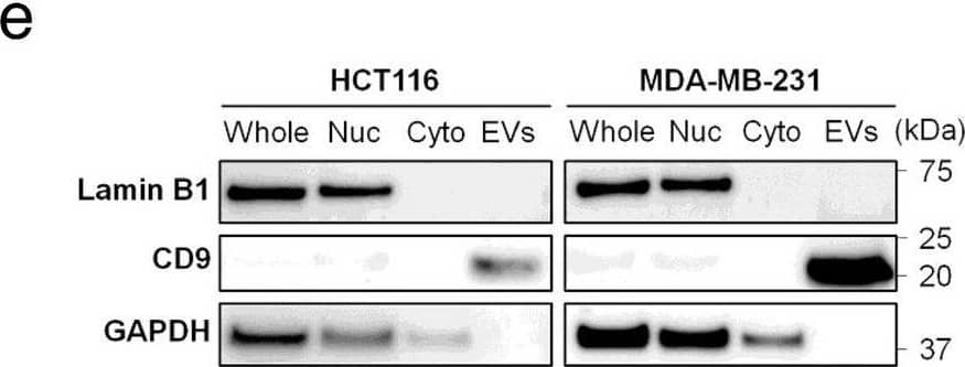 EV and cellular fraction characterization. (a) Methodological workflow for this study. (b) Transmission Electron Microscopy (TEM) analysis of extracellular vesicles (EVs)-derived from HCT116 and MDA-MD-231 cell lines. (c) Particle size distribution of EV samples derived from HCT116 (top) and MDA-MB-231 (bottom) cell line. Mean size, mode size (the most frequent size), and standard deviation (SD) values of EV samples were determined by NanoSight Tracking Analysis (NTA). (d) Representative fluorescence images of EV samples derived from HCT116 (left side) and MDA-MB-231 (right side) cell line. EV samples were captured by specific antibody-coated chips against anti-CD9 (blue), anti-CD63 (red), and anti-CD81 (green) antibodies. (e) Western blot analysis of whole cell lysates (whole), nucleic fraction (nuc), cytoplasmic fraction (cyto), and EVs from HCT116 and MDA-MB-231 cell lines. The membranes were probed for Lamin B1 (nuclear marker), CD9 (EV marker), and GAPDH (loading control). (f) Electropherograms and virtual gel images showing the profiles of total genomic DNA, nuclear DNA (nDNA), cytoplasmic DNA (cytoDNA), and extracellular vesicle-derived DNA (evDNA) from HCT116 (left side) and MDA-MB-231 (right side) cell lines. Image collected and cropped by CiteAb from the following open publication (//pubmed.ncbi.nlm.nih.gov/39406948), licensed under a CC-BY license. Not internally tested by Novus Biologicals.