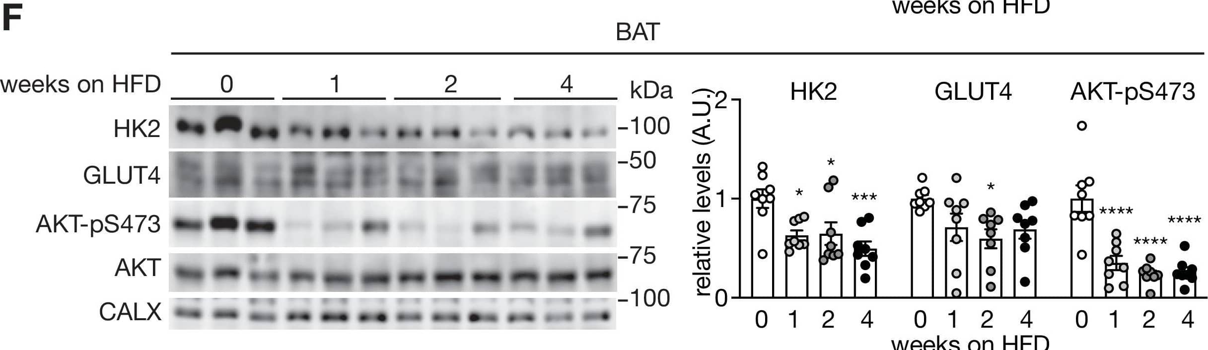 Supporting data 2 for Figure 1.(A-B) Body weight (A) and fasting glucose levels (B) of mice fed a HFD for 0, 1, 2, or 4 weeks. One-way ANOVA compared to 0 week HFD-fed mice, **p<0.01, ***p<0.001, ****p<0.0001. n=10 (C) ITT on mice fed a HFD for 0, 1, 2, 4 weeks, and mice fed 2 week HFD and 2 week ND. The mice were fasted for 6 hours and injected with insulin (0.75 U/kg body weight). One-way ANOVA, *p<0.05. n=8 (0 week ND), 10 (1 week HFD), 10 (2 week HFD), 10 (2 week HFD), and 6 (2 week HFD +2 week ND). (D–F) Immunoblots of vWAT(D), sWAT(E), and BAT (F) from mice fed a HFD for 0, 1, 2, or 4 weeks. Mice were fasted for 6 hours and injected with insulin (0.75 U/kg body weight). n=5. See Figure 1—figure supplement 2—source data 1.Figure 1—figure supplement 2—source data 1.Uncropped blots and source data for graphs for Figure 1—figure supplement 2.Uncropped blots and source data for graphs for Figure 1—figure supplement 2. Image collected and cropped by CiteAb from the following open publication (//pubmed.ncbi.nlm.nih.gov/36920797), licensed under a CC-BY license. Not internally tested by Novus Biologicals.