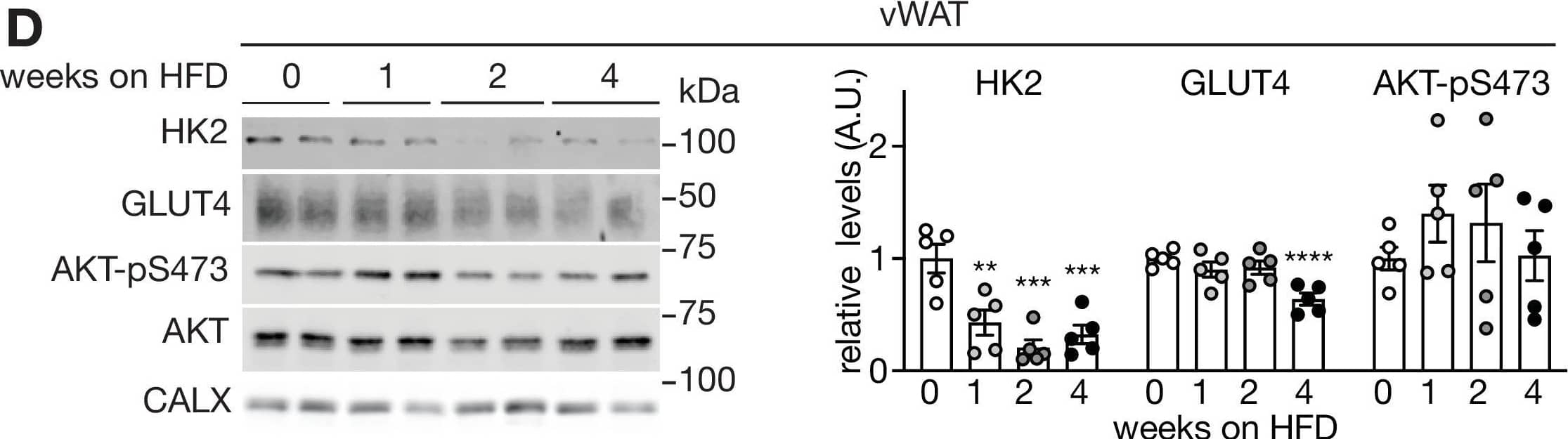 Supporting data 2 for Figure 1.(A-B) Body weight (A) and fasting glucose levels (B) of mice fed a HFD for 0, 1, 2, or 4 weeks. One-way ANOVA compared to 0 week HFD-fed mice, **p<0.01, ***p<0.001, ****p<0.0001. n=10 (C) ITT on mice fed a HFD for 0, 1, 2, 4 weeks, and mice fed 2 week HFD and 2 week ND. The mice were fasted for 6 hours and injected with insulin (0.75 U/kg body weight). One-way ANOVA, *p<0.05. n=8 (0 week ND), 10 (1 week HFD), 10 (2 week HFD), 10 (2 week HFD), and 6 (2 week HFD +2 week ND). (D–F) Immunoblots of vWAT(D), sWAT(E), and BAT (F) from mice fed a HFD for 0, 1, 2, or 4 weeks. Mice were fasted for 6 hours and injected with insulin (0.75 U/kg body weight). n=5. See Figure 1—figure supplement 2—source data 1.Figure 1—figure supplement 2—source data 1.Uncropped blots and source data for graphs for Figure 1—figure supplement 2.Uncropped blots and source data for graphs for Figure 1—figure supplement 2. Image collected and cropped by CiteAb from the following open publication (//pubmed.ncbi.nlm.nih.gov/36920797), licensed under a CC-BY license. Not internally tested by Novus Biologicals.