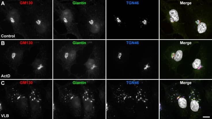 Effect of Actinomycin D and Vinblastine on the Golgi apparatus of MDA-MB-231 cells.Cells were left untreated (A; Control), or treated for 60 min either with 10 ng/ml Actinomycin D (B; ActD) or 25 nM Vinblastine (C; VLB). Cells were fixed, permeabilized, and immunolabeled with mouse monoclonal antibody to GM130, rabbit polyclonal antibody to Giantin, and sheep antibody to TGN46. Secondary antibodies were Alexa-594-conjugated donkey anti-mouse IgG (red channel), Alexa-488-conjugated donkey anti-rabbit IgG (green channel), and Alexa-647-conjugated donkey anti-sheep IgG (blue channel). Nuclei were stained with DAPI (gray channel). Stained cells were examined by fluorescence microscopy. Merging red, green, blue, and grey channels generated the fourth image on each row; yellow indicates overlapping localization of the red and green channels, cyan indicates overlapping localization of the green and blue channels, magenta indicates overlapping localization of the red and blue channels, and white indicates overlapping localization of all three channels. Bar, 10 μm. Image collected and cropped by CiteAb from the following open publication (//pubmed.ncbi.nlm.nih.gov/29614107), licensed under a CC-BY license. Not internally tested by Novus Biologicals.