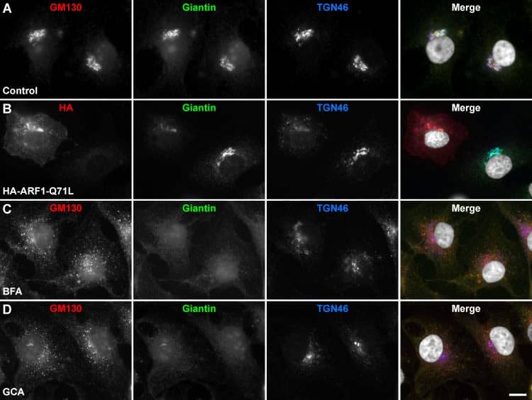 Effect of Golgi disrupting treatments on the Golgi apparatus of MDA-MB-231 cells.Cells were left untreated (A; Control), or transfected to transiently express the HA-epitope-tagged ARF1 constitutively-activated mutant for 16 h (B; HA-ARF1-Q71L), or treated for 60 min either with 5 μg/ml Brefeldin A (C; BFA) or 10 μM Golgicide A (D; GCA). Cells were fixed, permeabilized, and immunolabeled with mouse monoclonal antibody to GM130, rabbit polyclonal antibody to Giantin, and sheep antibody to TGN46. Secondary antibodies were Alexa-594-conjugated donkey anti-mouse IgG (red channel), Alexa-488-conjugated donkey anti-rabbit IgG (green channel), and Alexa-647-conjugated donkey anti-sheep IgG (blue channel). Nuclei were stained with DAPI (gray channel). Stained cells were examined by fluorescence microscopy. Merging red, green, blue, and grey channels generated the fourth image on each row; yellow indicates overlapping localization of the red and green channels, cyan indicates overlapping localization of the green and blue channels, magenta indicates overlapping localization of the red and blue channels, and white indicates overlapping localization of all three channels. Bar, 10 μm. Image collected and cropped by CiteAb from the following open publication (//pubmed.ncbi.nlm.nih.gov/29614107), licensed under a CC-BY license. Not internally tested by Novus Biologicals.