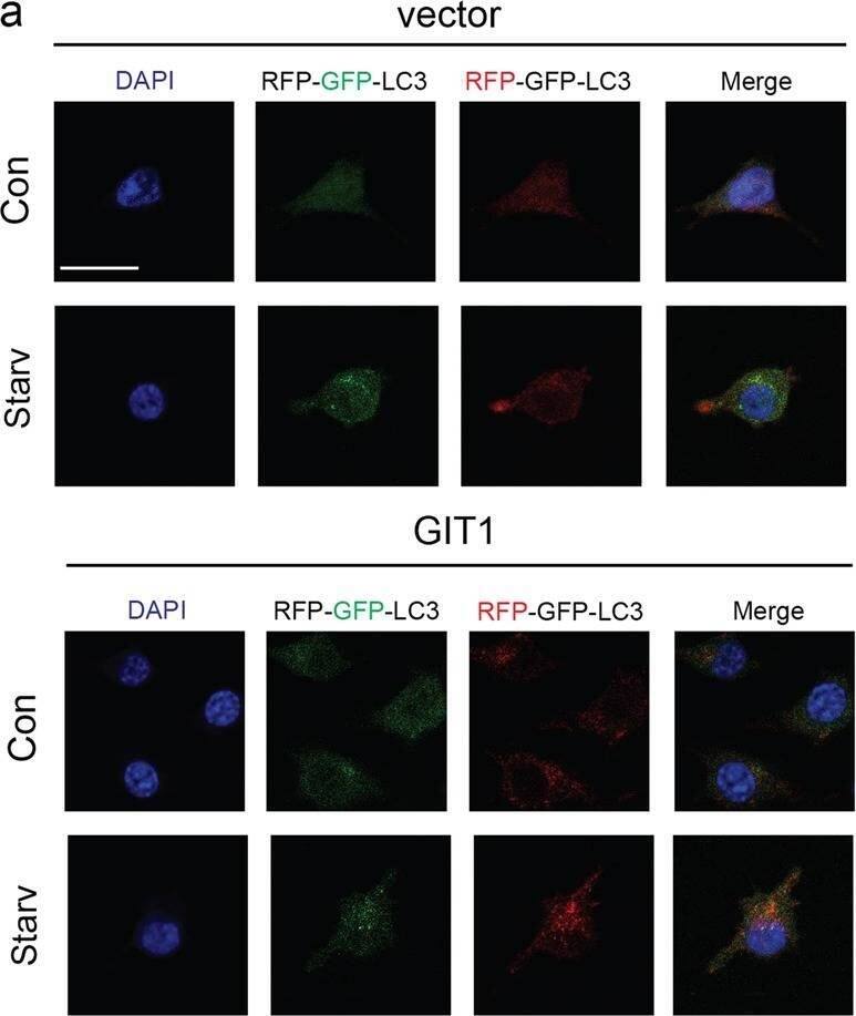 Overexpression of GIT1 promoted autophagic flux in HEK293T cells in vitro.a, b The control and GIT1-overexpressing HEK293T cells were transfected with mRFP–GFP–LC3. Effect of GIT1 overexpression in promoting LC3 puncta formation under non-starvation and starvation conditions. Shown are LC3 fluorescent signals from representative single cells. Representative images (a) and data summary (b) are shown (**p < 0.01, Kruskal–Wallis test). Scale bar = 20 μm Image collected and cropped by CiteAb from the following open publication (//pubmed.ncbi.nlm.nih.gov/30546041), licensed under a CC-BY license. Not internally tested by Novus Biologicals.