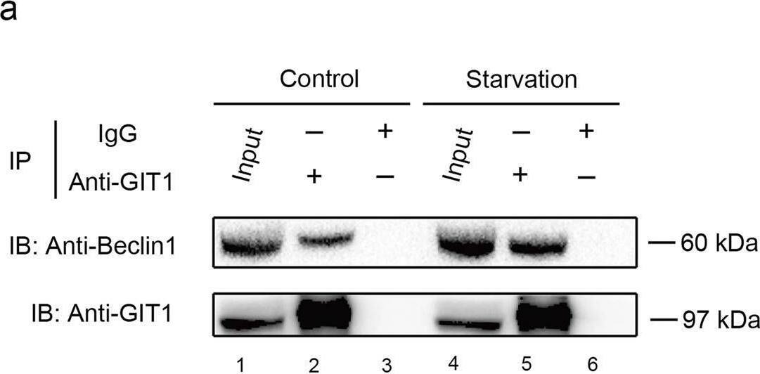 GIT1 physically interacts with Beclin1 and contributes to the disruption of Beclin1-Bcl2 binding in HEK293T cells.a–d Co-IP assays between GIT1 and Beclin1 under basal and starvation conditions. The pulling antibodies (anti-GIT1 antibody in a and anti-Beclin1 antibody in c) and the blotting antibodies are indicated. The cell lysates are displayed as input, and IgG is used as an internal control (values are means +/- SD, **p < 0.01, two-tailed Student's t-tests). e, f Co-IP assays between Beclin1 and Bcl2 with or without GIT1 under basal and starvation conditions. The pulling antibodies (anti-Beclin1 antibody) and the blotting antibodies are indicated. The cell lysates are displayed as input, and IgG is used as an internal control (values are means +/- SD, **p < 0.01, two-tailed Student's t-tests) Image collected and cropped by CiteAb from the following open publication (//pubmed.ncbi.nlm.nih.gov/30546041), licensed under a CC-BY license. Not internally tested by Novus Biologicals.