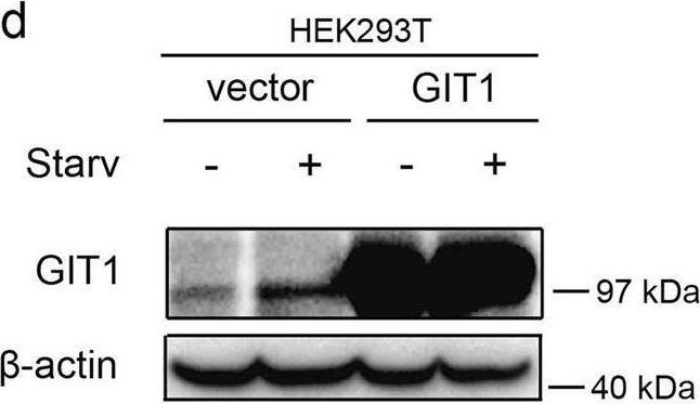 The role of GIT1 in autophagy of osteoclasts and HEK293T cells.a Amino-acid starvation in Earle’s balanced salt solution (EBSS) for different time durations (0, 0.5, 1.0, and 2.0 h) progressively increased the expression of GIT1 and LC3-II in osteoclasts. b The expression of GIT1 and LC3-II were both gradually upregulated under amino-acid starvation conditions in EBSS for different time durations (0, 1.0, and 2.0 h) in HEK293T cells. c The effectiveness of siRNA1 in knocking down GIT1 expression in osteoclasts under basal and starvation conditions. si-NC was used as the control. d The efficacy of GIT1-HA in overexpression of GIT1 in HEK293T cells under non-starvation and starvation conditions. e, f The effect of GIT1 knockdown in lowering the LC3-II level under non-starvation or starvation conditions (1 h) with or without bafilomycin A1 (Baf, 10 nM) in osteoclasts. Bafilomycin A1 was used to inhibit LC3-II degradation. Representative immunoblot images (e) and data summary (f) are shown (*p < 0.05, **p < 0.01, ns indicates no significance, Kruskal–Wallis test). g, h The effect of GIT1 overexpression in increasing the LC3-II level under basal or starvation conditions with or without bafilomycin A1 (Baf, 10 nM) in HEK293T cells. Representative images (g) and data summary (h) are shown (**p < 0.01, Kruskal–Wallis test) Image collected and cropped by CiteAb from the following open publication (//pubmed.ncbi.nlm.nih.gov/30546041), licensed under a CC-BY license. Not internally tested by Novus Biologicals.