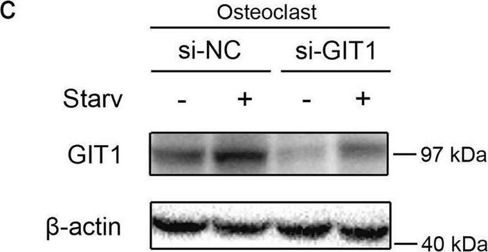 The role of GIT1 in autophagy of osteoclasts and HEK293T cells.a Amino-acid starvation in Earle’s balanced salt solution (EBSS) for different time durations (0, 0.5, 1.0, and 2.0 h) progressively increased the expression of GIT1 and LC3-II in osteoclasts. b The expression of GIT1 and LC3-II were both gradually upregulated under amino-acid starvation conditions in EBSS for different time durations (0, 1.0, and 2.0 h) in HEK293T cells. c The effectiveness of siRNA1 in knocking down GIT1 expression in osteoclasts under basal and starvation conditions. si-NC was used as the control. d The efficacy of GIT1-HA in overexpression of GIT1 in HEK293T cells under non-starvation and starvation conditions. e, f The effect of GIT1 knockdown in lowering the LC3-II level under non-starvation or starvation conditions (1 h) with or without bafilomycin A1 (Baf, 10 nM) in osteoclasts. Bafilomycin A1 was used to inhibit LC3-II degradation. Representative immunoblot images (e) and data summary (f) are shown (*p < 0.05, **p < 0.01, ns indicates no significance, Kruskal–Wallis test). g, h The effect of GIT1 overexpression in increasing the LC3-II level under basal or starvation conditions with or without bafilomycin A1 (Baf, 10 nM) in HEK293T cells. Representative images (g) and data summary (h) are shown (**p < 0.01, Kruskal–Wallis test) Image collected and cropped by CiteAb from the following open publication (//pubmed.ncbi.nlm.nih.gov/30546041), licensed under a CC-BY license. Not internally tested by Novus Biologicals.