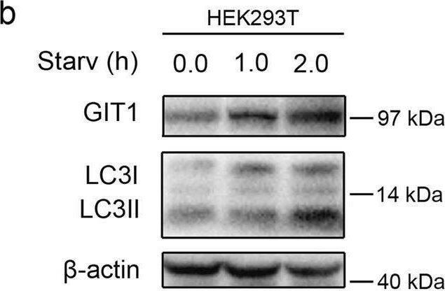 The role of GIT1 in autophagy of osteoclasts and HEK293T cells.a Amino-acid starvation in Earle’s balanced salt solution (EBSS) for different time durations (0, 0.5, 1.0, and 2.0 h) progressively increased the expression of GIT1 and LC3-II in osteoclasts. b The expression of GIT1 and LC3-II were both gradually upregulated under amino-acid starvation conditions in EBSS for different time durations (0, 1.0, and 2.0 h) in HEK293T cells. c The effectiveness of siRNA1 in knocking down GIT1 expression in osteoclasts under basal and starvation conditions. si-NC was used as the control. d The efficacy of GIT1-HA in overexpression of GIT1 in HEK293T cells under non-starvation and starvation conditions. e, f The effect of GIT1 knockdown in lowering the LC3-II level under non-starvation or starvation conditions (1 h) with or without bafilomycin A1 (Baf, 10 nM) in osteoclasts. Bafilomycin A1 was used to inhibit LC3-II degradation. Representative immunoblot images (e) and data summary (f) are shown (*p < 0.05, **p < 0.01, ns indicates no significance, Kruskal–Wallis test). g, h The effect of GIT1 overexpression in increasing the LC3-II level under basal or starvation conditions with or without bafilomycin A1 (Baf, 10 nM) in HEK293T cells. Representative images (g) and data summary (h) are shown (**p < 0.01, Kruskal–Wallis test) Image collected and cropped by CiteAb from the following open publication (//pubmed.ncbi.nlm.nih.gov/30546041), licensed under a CC-BY license. Not internally tested by Novus Biologicals.