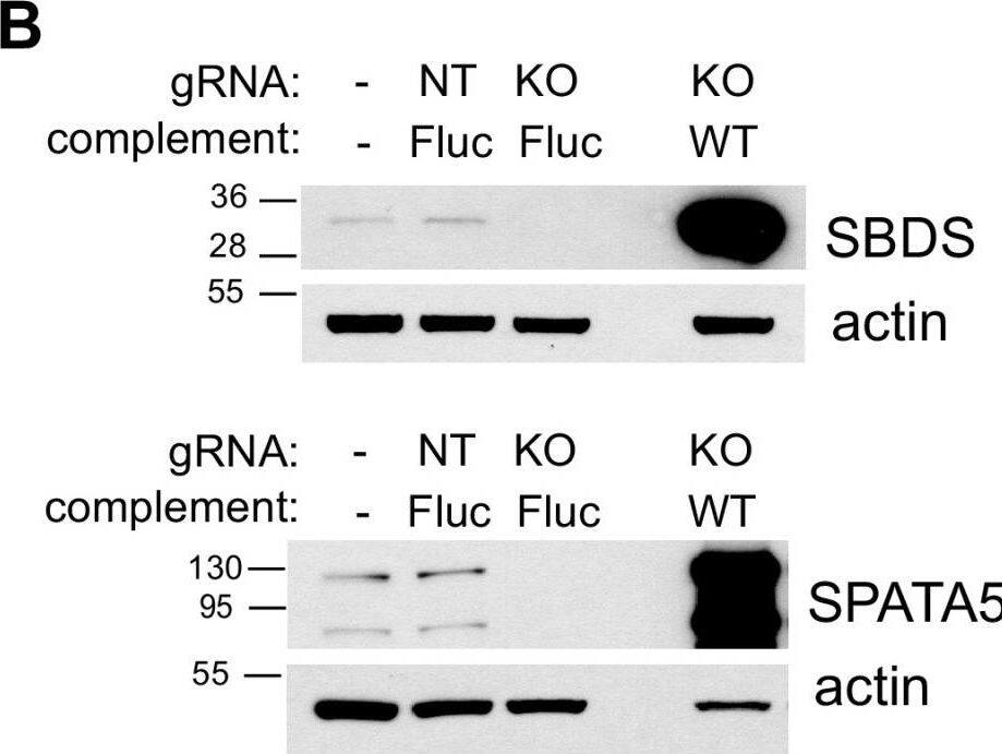 Genetic reconstitution of viral infection by expression of SBDS and SPATA5. (A) Infectivity of Huh7.5 cells treated with indicated CRISPR gRNAs and complemented with lentiviral expression of firefly luciferase (Fluc) or guide-resistant host factors infected with MOI 1 YFV-Venus for 24 h and analyzed by flow cytometry. (B) Lysates from Huh7.5 cells untreated or treated with indicated CRISPR gRNAs and complemented with lentiviral expression of Fluc or guide-resistant host factors were analyzed by Western blotting using anti-SBDS or anti-SPATA5 antibodies. Blot membranes were also probed with anti-actin antibodies (indicated) (n = 3 biological replicates). Statistical significance was determined by two-way ANOVA. KO, knockout; NonTarg or NT, nontargeting CRISPR guides; WT, wild type; ****, P < 0.0001. Image collected and cropped by CiteAb from the following open publication (//pubmed.ncbi.nlm.nih.gov/36809113), licensed under a CC-BY license. Not internally tested by Novus Biologicals.