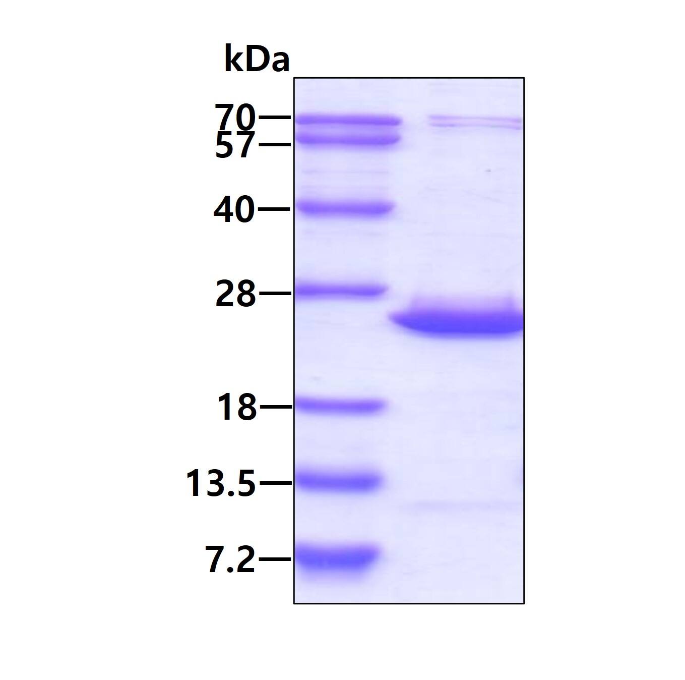 SDS-PAGE: Recombinant Human BCL2L10 His Protein [NBP2-22709] - 3ug by SDS-PAGE under reducing condition and visualized by coomassie blue stain.