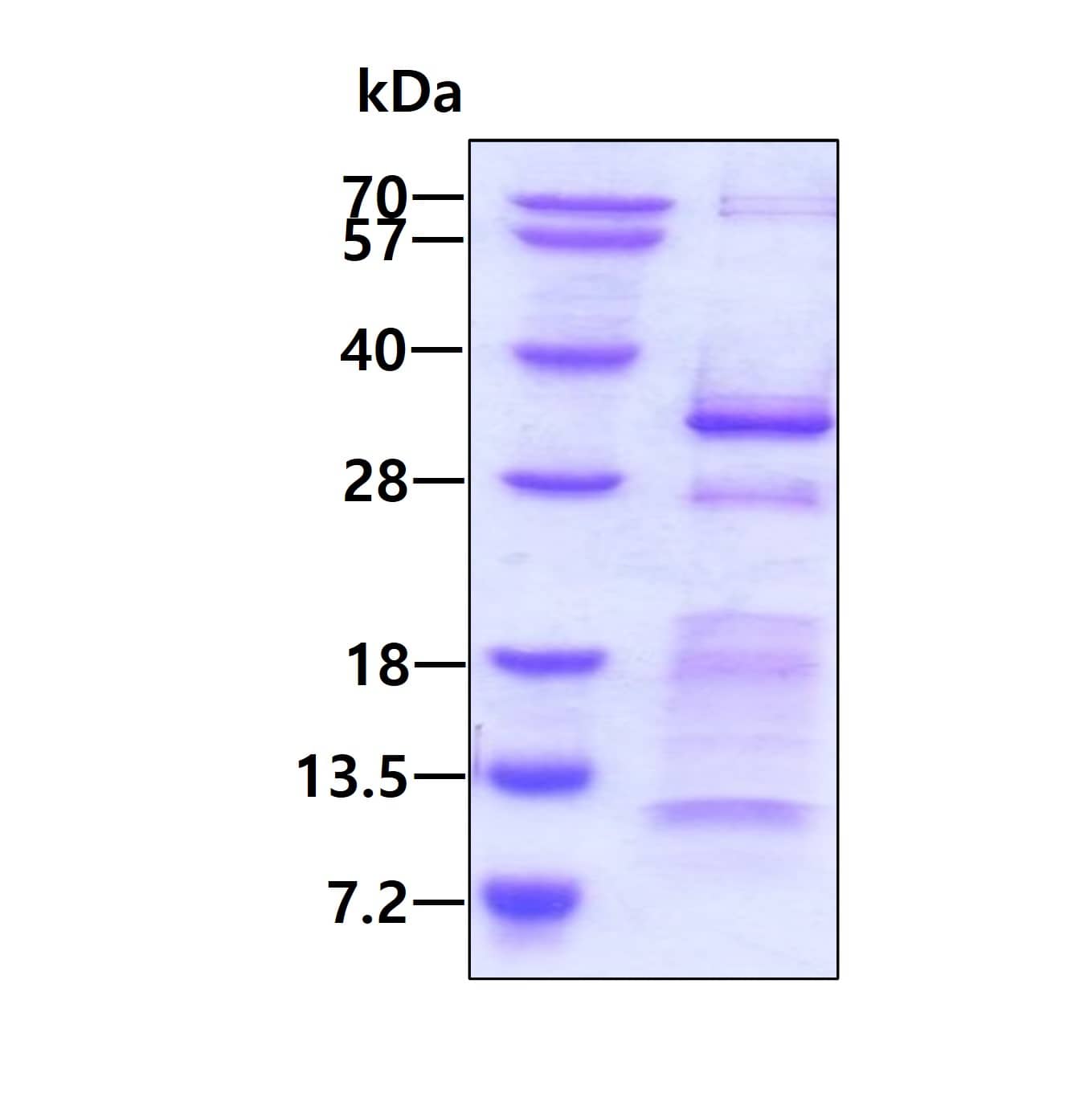 SDS-PAGE Recombinant Human CHMP5 His Protein