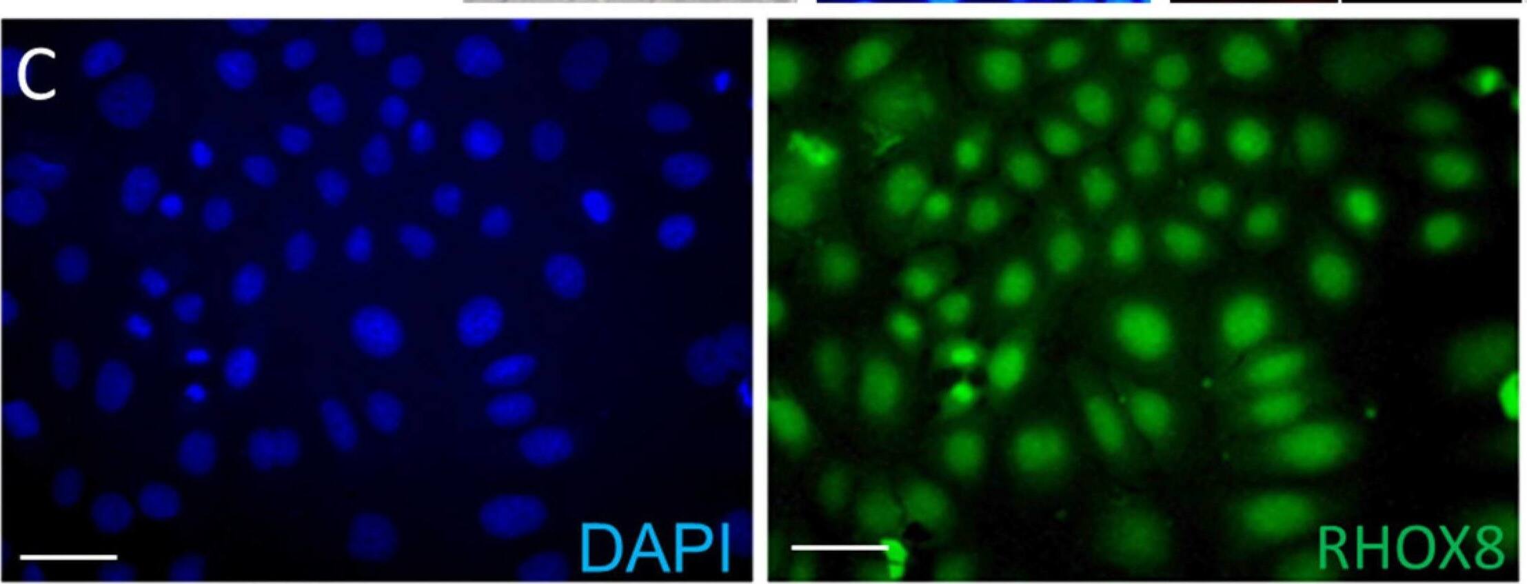 Generation of a stable RHOX8-expressing SIGC line. (A) The endogenous levels of rat Rhox5 and Rhox8 were determined in parental SIGC cells by qPCR (n = 6). (B) SIGC cells lack robust nuclear RHOX8 expression as assessed by immunofluorescence in two independent SIGC cultures. (C) The stable integration of Rhox8 transgene into the flip-in site of LacZeo competent SIGC cells resulted in uniform abundant nuclear expression of RHOX8. (D) The expression of RHOX8 could be inhibited by the addition of a Rhox8 siRNA cocktail. The non-specific staining of a dying GC lifting off the plate is indicated by the asterisk (*). Scale bars = 50 um. Image collected and cropped by CiteAb from the following open publication (//pubmed.ncbi.nlm.nih.gov/40214432), licensed under a CC-BY license. Not internally tested by Novus Biologicals.