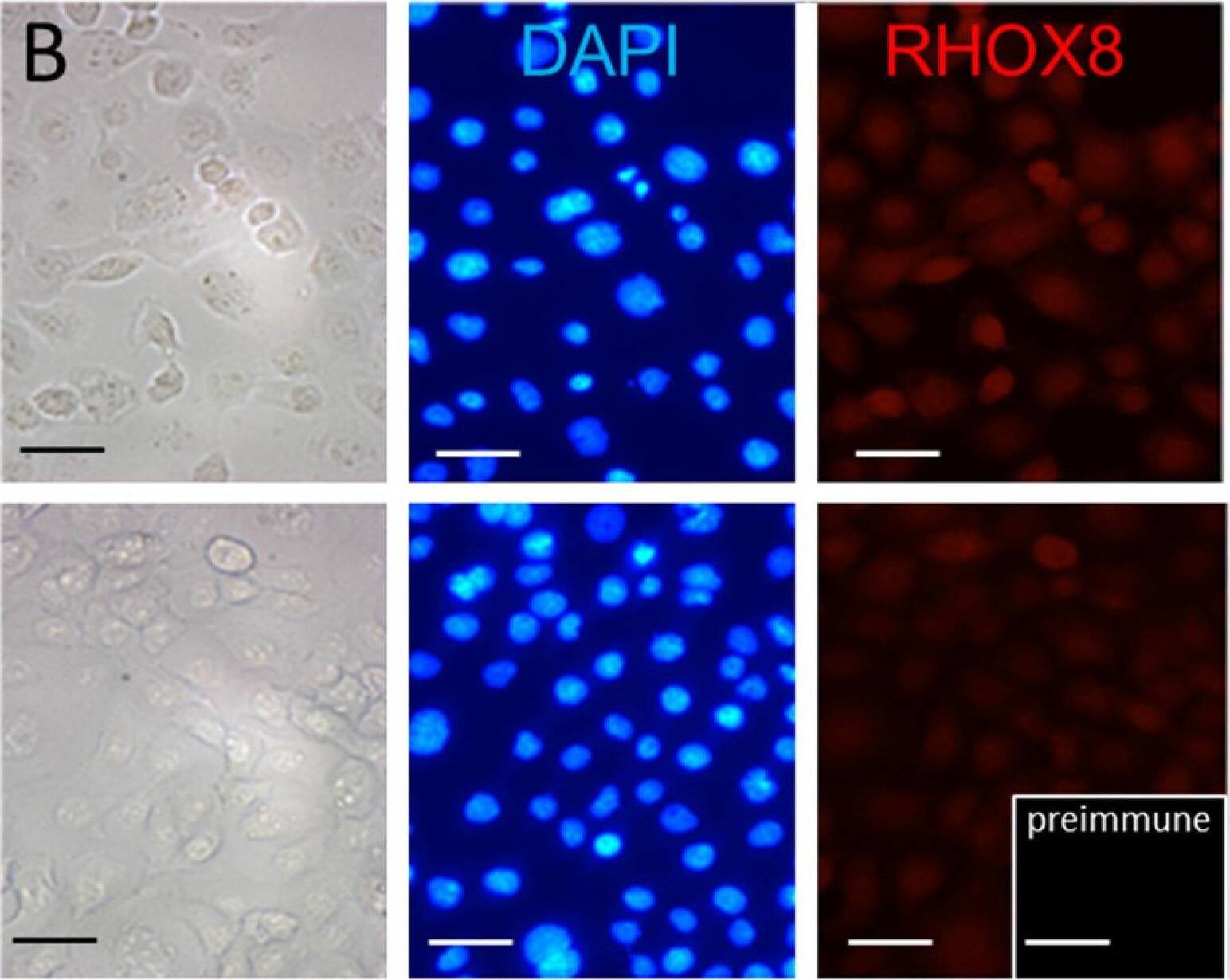 Generation of a stable RHOX8-expressing SIGC line. (A) The endogenous levels of rat Rhox5 and Rhox8 were determined in parental SIGC cells by qPCR (n = 6). (B) SIGC cells lack robust nuclear RHOX8 expression as assessed by immunofluorescence in two independent SIGC cultures. (C) The stable integration of Rhox8 transgene into the flip-in site of LacZeo competent SIGC cells resulted in uniform abundant nuclear expression of RHOX8. (D) The expression of RHOX8 could be inhibited by the addition of a Rhox8 siRNA cocktail. The non-specific staining of a dying GC lifting off the plate is indicated by the asterisk (*). Scale bars = 50 um. Image collected and cropped by CiteAb from the following open publication (//pubmed.ncbi.nlm.nih.gov/40214432), licensed under a CC-BY license. Not internally tested by Novus Biologicals.