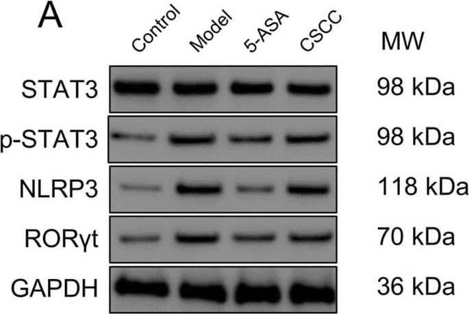 Western Blot ROR gamma/RORC/NR1F3 Antibody - BSA Free