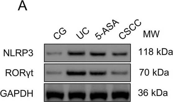 Western Blot ROR gamma/RORC/NR1F3 Antibody - BSA Free
