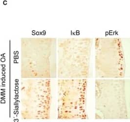 Immunohistochemistry-Paraffin: SOX9 Antibody [NBP2-24659] - 3′‐Sialyllactose regulates anabolic & catabolic factor expression via Erk & NF‐ kappa B pathways. (A, B) Chondrocytes were pre‐treated with different concentrations of 3′‐sialyllactose for 24 hrs prior to treatment with IL‐1 beta  (5 ng/ml) for 10 min. Erk phosphorylation was measured by Western blotting (A, upper panel) & densitometry (A, lower panel). The protein level of I kappa B was detected by Western blotting (B, upper panel) & densitometry (B, lower panel). Erk was detected as a loading control. (C) Immunohistochemical staining of Sox9, I kappa B & pErk in DMM‐induced OA mice with administration of PBS & 3′‐sialyllactose. (D) Schematic diagram of the signalling pathway leading to Sox9 activation & NF‐ kappa B inhibition by 3′‐sialyllactose. Values represent the means ± S.E.M. *P < 0.05. Image collected & cropped by CiteAb from the following publication (//pubmed.ncbi.nlm.nih.gov/28782172), licensed under a CC-BY license. Not internally tested by Novus Biologicals.