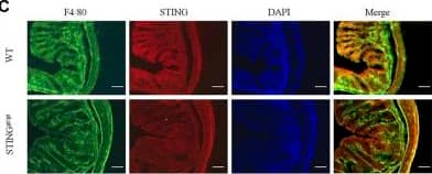 STING deficiency attenuated DSS-colitis in mice. (A) Representative Western blotting detected cGAS and STING expression in STINGgt/gt and WT mice. (B) Statistical analysis for (A). (C) Representative immunofluorescence detected STING and F4/80 expression in STINGgt/gt and WT mice. (D) Statistical analysis for (C). (n = 3 each group, **p < 0.01, STINGgt/gt vs. vehicle group; unpaired Student’s t-test). Wild-type (WT) and STINGgt/gt mice were given 3% dextran sulfate sodium (DSS) in drinking water for 8 days. (E) Body weight changed following DSS administration in mice. (F) The quantification of AUC for (E). (G) DSS-induced changes of DAI score in WT and STINGgt/gt mice. (H) The quantification of AUC for (G). (I) DSS-induced changes of mechanical pain sensitivity in the abdomen in STINGgt/gt mice and WT mice. (J) The quantification of AUC for (I). (n = 5-7 per group; **p < 0.01, ***p < 0.001, DSS vs. vehicle group; #p < 0.05, ##p < 0.01, ###p < 0.001, STINGgt/gt + DSS vs DSS group; two-way ANOVA with post-hoc Bonferroni test). (K) Representative pictures of colons from WT and STINGgt/gt mice on day 8. (L) Quantification of the colon length in (K). (n = 5-7 per group; ***p < 0.001, ###p < 0.001; unpaired Student’s t-test). (M) Representative photographies of H&E staining of colon sections from 4 different groups. (N) Statistical analysis for (M) (n = 4 each group; ***p < 0.001, #p < 0.05; unpaired Student’s t-test). (O) The Q-PCR analysis of mRNA expression of colonic Cgas, Il10, Ifnb1, Cxcl10, Il1b, and Tnf in mice from different group (n = 6 each group, **p < 0.01, ***p < 0.001, #p < 0.05, ##p < 0.01, ###p < 0.001; unpaired Student’s t-test). All data was expressed as Mean +/- SEM. DSS, dextran sulfate sodium; n.s., no significance. WT, wild type. Image collected and cropped by CiteAb from the following open publication (//pubmed.ncbi.nlm.nih.gov/36467059), licensed under a CC-BY license. Not internally tested by Novus Biologicals.