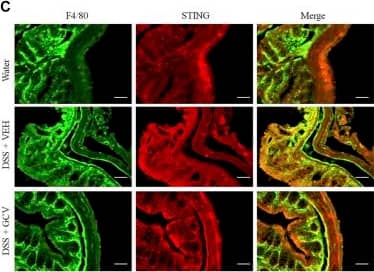 Low-dose GCV attenuated cGAS-STING pathways in the colon of DSS-colitis in mice. (A) Western blotting analysis showed that protein expression of colonic STING, cGAS, p-TBK1, IFN-beta , IL-1 beta , and TNF-alpha  in mice of different treatment group. (B) Statistical analysis for (A) (n = 4 per group, *p < 0.05, **p < 0.01, DSS vs. vehicle group; #p < 0.05, ##p < 0.01, ###p < 0.001, GCV + DSS vs. DSS group; unpaired Student’s t-test). (C) Double immunostaining of STING and F4/80 in the colon tissue. (D) Statistical results for (C). Scale bar = 50 μm. (n = 4 each group, ***p < 0.001, ##p < 0.01; unpaired Student’s t-test). All data was expressed as Mean +/- SEM. Image collected and cropped by CiteAb from the following open publication (//pubmed.ncbi.nlm.nih.gov/36467059), licensed under a CC-BY license. Not internally tested by Novus Biologicals.