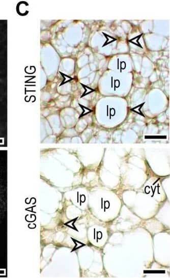 Expression of STING and cGAS mRNA and protein in adipocytes. (A) Venn diagram summarizing the number of equally and differently expressed mRNA transcripts of young and adult mouse iAT. A gene network associated with Sting1 was equally expressed by young and adult iAT. A protein–protein interaction map, generated by STRING [30] is shown below the Venn diagram. Extended analysis presented in [24]. (B) Immunofluorescence of in vitro cultured adipocytes from young and adult mouse iAT; nc: nucleus, scale bar 20 μm. (C) Immunostaining of STING and cGAS proteins in the iAT of young mice, showing a region containing both multilocular and unilocular adipocytes. Arrowheads label nuclei; lp: lipid droplet; cyt: cytoplasm; scale bar: 50 μm. (D) Top: Expression of STING1 and CGAS mRNA in human inguinal and abdominal adipose tissue specimens. Linear regression analysis indicates a significant positive correlation between STING1 and CGAS mRNA levels. Each data point represents one tissue donor patient. Bottom: Correlation of donor age and the adipose tissue expression levels of STING1 and CGAS. (E) Immunohistochemistry of STING and cGAS proteins in human adipose tissue, collected from the inguinal-low abdominal region. Nineteen-month-old male infant; arrowheads label nuclei; lp: lipid droplet; cyt: cytoplasm; scale bar: 25 μm. Inlet shows nuclear STING labeling of an in vitro cultured human adipocyte. Scale bar: 20 μm. (F) Body mass index z-score (BMI z-score) and BMI standard deviation score (BMI-SDS) of adipose tissue donors involved in this study. Correlation of BMI z-score with adipose tissue STING1 and CGAS mRNA levels. Image collected and cropped by CiteAb from the following open publication (//pubmed.ncbi.nlm.nih.gov/37830559), licensed under a CC-BY license. Not internally tested by Novus Biologicals.