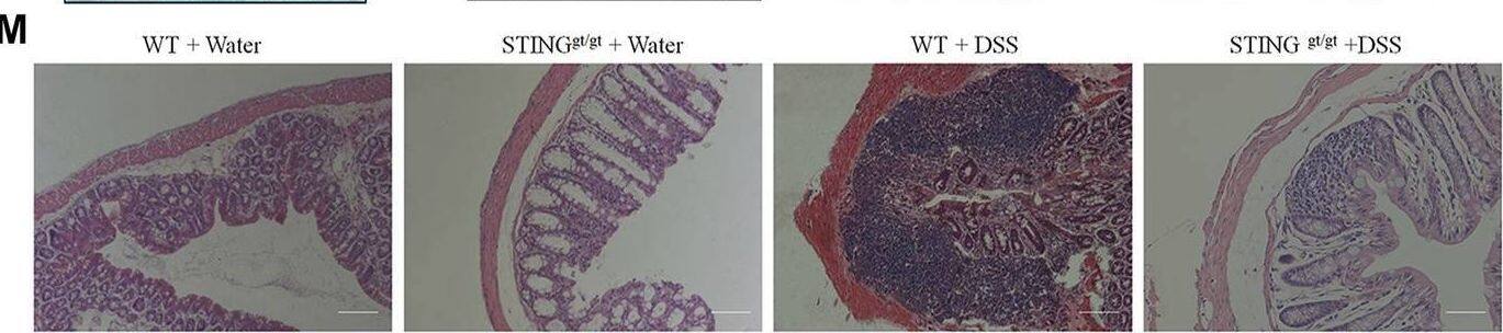 STING deficiency attenuated DSS-colitis in mice. (A) Representative Western blotting detected cGAS and STING expression in STINGgt/gt and WT mice. (B) Statistical analysis for (A). (C) Representative immunofluorescence detected STING and F4/80 expression in STINGgt/gt and WT mice. (D) Statistical analysis for (C). (n = 3 each group, **p < 0.01, STINGgt/gt vs. vehicle group; unpaired Student’s t-test). Wild-type (WT) and STINGgt/gt mice were given 3% dextran sulfate sodium (DSS) in drinking water for 8 days. (E) Body weight changed following DSS administration in mice. (F) The quantification of AUC for (E). (G) DSS-induced changes of DAI score in WT and STINGgt/gt mice. (H) The quantification of AUC for (G). (I) DSS-induced changes of mechanical pain sensitivity in the abdomen in STINGgt/gt mice and WT mice. (J) The quantification of AUC for (I). (n = 5-7 per group; **p < 0.01, ***p < 0.001, DSS vs. vehicle group; #p < 0.05, ##p < 0.01, ###p < 0.001, STINGgt/gt + DSS vs DSS group; two-way ANOVA with post-hoc Bonferroni test). (K) Representative pictures of colons from WT and STINGgt/gt mice on day 8. (L) Quantification of the colon length in (K). (n = 5-7 per group; ***p < 0.001, ###p < 0.001; unpaired Student’s t-test). (M) Representative photographies of H&E staining of colon sections from 4 different groups. (N) Statistical analysis for (M) (n = 4 each group; ***p < 0.001, #p < 0.05; unpaired Student’s t-test). (O) The Q-PCR analysis of mRNA expression of colonic Cgas, Il10, Ifnb1, Cxcl10, Il1b, and Tnf in mice from different group (n = 6 each group, **p < 0.01, ***p < 0.001, #p < 0.05, ##p < 0.01, ###p < 0.001; unpaired Student’s t-test). All data was expressed as Mean +/- SEM. DSS, dextran sulfate sodium; n.s., no significance. WT, wild type. Image collected and cropped by CiteAb from the following open publication (//pubmed.ncbi.nlm.nih.gov/36467059), licensed under a CC-BY license. Not internally tested by Novus Biologicals.