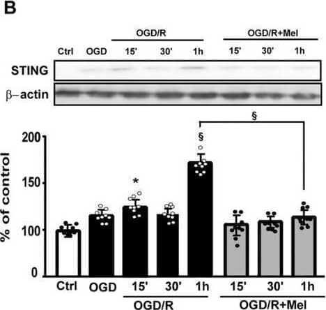 cGAS, STING and HMGB‐1 expressions in HT22 cells after OGD/R and melatonin treatment. (A) Quantitative evaluation and representative Western blots of cGAS, STING (B) and nuclear (C) and cytosolic (D) HMGB‐1 expressions in untreated HT22 cells (Ctrl), 8‐h OGD‐exposed cells (OGD) or followed by 15 min, 30 min or 1 h of reoxygenation (OGD/R) and 8‐h OGD‐exposed cells followed by 15 min, 30 min or 1 h of reoxygenation in the presence of 50 μM melatonin (OGD/R + Mel). Data normalised to the loading control  beta ‐actin or lamin A are expressed as % of control and are the mean +/- SD (N = 3 independent experiments performed in triplicate); *p < 0.05, **p < 0.01, §p < 0.001 vs Ctrl; **p < 0.01, §p < 0.001, bars. Image collected and cropped by CiteAb from the following open publication (//pubmed.ncbi.nlm.nih.gov/39707673), licensed under a CC-BY license. Not internally tested by Novus Biologicals.