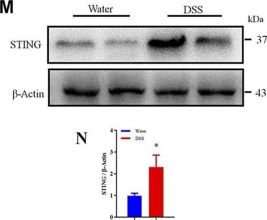 STING was upregulated following DSS-induced chronic colitis in mice and in UC patients. (A) Body weight loss was induced by DSS-colitis in mice. (B) The quantification of area under the curve (AUC) for (A). (C) DSS-colitis induced changes of the Disease activity index (DAI) score. (D) The quantification of AUC for (C). (E) DSS-colitis induced mechanical pain hypersensitivity in the abdomen. (F) The quantification of AUC for (E). (n = 7-8 per group; *p < 0.05, **p < 0.05, ***p < 0.001, DSS vs. vehicle group; two-way ANOVA with post-hoc Bonferroni test). (G) Representative pictures showed colon shortening induced by DSS. (H) The quantification of colon shortening for (G). (n = 7-8 per group; ***p < 0.001, DSS vs. vehicle group; unpaired Student’s t-test). (I) Representative H&E staining of colon sections from DSS group and vehicle group. (J) Statistical analysis for (I). (n = 4 each group, ***p < 0.001, DSS vs. vehicle group; unpaired Student’s t-test). (K) Double immunostaining of STING and F4/80 in the colon tissue from DSS group and vehicle group. (L) Statistical analysis for (K), scale bar: 50 μm. (n = 4 each group, *p < 0.05, DSS vs. vehicle group; unpaired Student’s t-test). (M) Western blotting analysis of STING expression in colon of mice. (N) Statistical analysis of Western blotting. (n = 3 each group, *p < 0.05, DSS vs. vehicle group; unpaired Student’s t-test). (O) The expression of STING in the colon tissue was increased in patients with ulcerative colitis compared with adjacent tissue of colon cancer. (P) Statistical analysis results for (O). (n = 4; **p < 0.01 vs Normal; unpaired Student’s t-test). The scale bar: 20 μm. All data was expressed as Mean +/- SEM. DAI, disease activity index; DSS, dextran sulfate sodium. Image collected and cropped by CiteAb from the following open publication (//pubmed.ncbi.nlm.nih.gov/36467059), licensed under a CC-BY license. Not internally tested by Novus Biologicals.