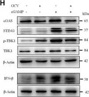 Low-dose GCV inhibited cGAS-STING pathways in RAW264.7 cells. (A–C) Q-PCR analysis showed the effect of pretreatment of GCV on up-regulation of mRNA expression of Sting1, Il10, Ifnb1 induced by CMA- (A), DMXAA- (B), and cGAMP (C) in RAW264.7 cells. (D) Western blotting analysis showed the effect of GCV on CMA-induced expression changes of cGAS, STING, IFN-beta , and p-TBK1 in RAW264.7 cells. (E) Statistical analysis results for (D). (F) Western blotting analysis showed the effect of GCV on DMXAA-induced expression changes of cGAS, STING, IFN-beta , and p-TBK1 in RAW264.7 cells. (G) Statistical analysis results for (F). (H) Western blotting analysis showed the effect of GCV on cGAMP-induced expression changes of cGAS, STING, IFN-beta , and p-TBK1 in RAW264.7 cells. (I) Statistical analysis results for (H). (n = 4 each group, *p < 0.05, **p < 0.01, ***p < 0.001 vs. saline. &p < 0.05, &&p < 0.01, &&&p < 0.001 vs. STING agonists group, unpaired Student’s t-test). (n = 4 each group, *p < 0.05, **p < 0.01, ***p < 0.001, &&p < 0.01, &&&p < 0.001; unpaired Student’s t-test). All data was expressed as Mean +/- SEM. VEH, vehicle. Image collected and cropped by CiteAb from the following open publication (//pubmed.ncbi.nlm.nih.gov/36467059), licensed under a CC-BY license. Not internally tested by Novus Biologicals.