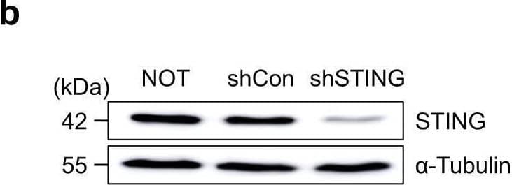 STING pathway of tumour cells is not required for cGAMP-induced tumour EC apoptosis.a, b mRNA and protein levels of STING in cultured LLC cells transduced with nothing (NOT), shControl (shCon) or shSTING. Each dot indicates a value from one sample and n = 3 from two independent experiments. Vertical bars indicate mean +/- SD. c–e Diagram depicting generation of implanted LLC tumour by injection of the LLC cells transduced with NOT, shCon or shSTING, and treatment schedule of i.t. PBS or cGAMP in B6 mice. Comparison of LLC tumour growths. n = 6 mice/group from three independent experiments. Dots and bars indicate mean +/- SD. Plot indicates each individual tumour growth. f–i Diagram depicting generation of implanted LLC tumour by injection of the LLC cells transduced with shCon or shSTING, i.t. PBS or cGAMP treatment, and sampling of tumours at 24 h later. Representative images and comparisons of apoptosis in tumour ECs and whole tumour cells (whole cells). White arrowheads indicate apoptotic ECs. Scale bars, 1.0 mm (yellow) and 100 μm (white). Each dot indicates a value from one mouse and n = 6 mice from four independent experiments. Vertical bars indicate mean +/- SD. P values by Welch’s one-way ANOVA test followed by Dunnett’s T3 test (a, d, i). ****P < 0.0001; ns, not significant. Source data are provided as a Source Data file. Image collected and cropped by CiteAb from the following open publication (//pubmed.ncbi.nlm.nih.gov/34285232), licensed under a CC-BY license. Not internally tested by Novus Biologicals.
