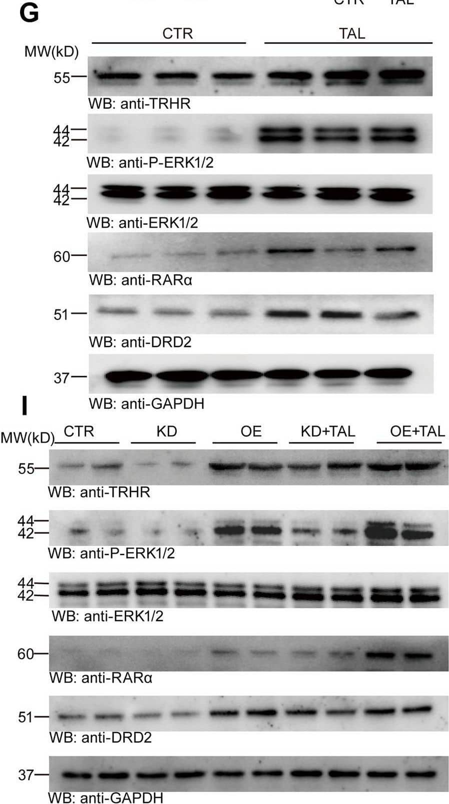 TAL enhances the expression of TRHR and DRD2 in SH-SY5Y cells. A, B Immunofluorescence colocalization of DRD2 with TRHR and RAR alpha  in SH-SHY5Y cells of the CTR and TAL groups. Scale bar: 25 μm. C, D Analysis of the relative fluorescence density of DRD2 and RAR alpha  in cells from the CTR and TAL groups (N = 8/group; error bars represent SEM). Statistical significance: ****P < 0.0001, Student’s t-test. E, F Analysis of the count of colocalized positive cells of DRD2 with TRHR and RAR alpha  in different groups of cells (N = 8/group; error bars represent SEM). Statistical significance: ****P < 0.0001, Student’s t-testt. G, H Western blotting analysis of TRHR, P-ERK1/2, ERK1/2, RAR alpha , and DRD2 levels in the SH-SY5Y of CTR and TAL group (N = 8/group; error bars represent SEM). Statistical significance: ****P < 0.0001, Student’s t-test. I, J After knockdown and overexpression of TRHR, Western blotting analysis of TRHR, P-ERK1/2, ERK1/2, RAR alpha , and DRD2 levels in each group of SH-SY5Y cells (N = 8/group; error bars represent SEM). Statistical significance: **P < 0.01, ****P < 0.0001, one-way ANOVA followed by Tukey's test Image collected and cropped by CiteAb from the following open publication (//pubmed.ncbi.nlm.nih.gov/39736794), licensed under a CC-BY license. Not internally tested by Novus Biologicals.