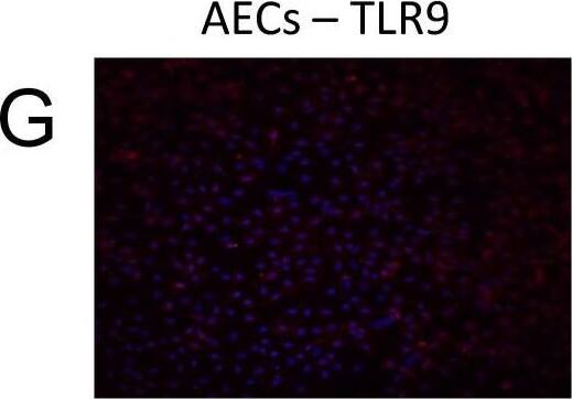 Immunocytochemistry/ Immunofluorescence TLR9 Antibody (26C593.2) - BSA Free