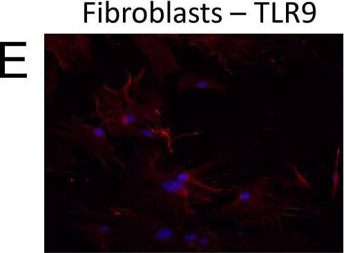Immunocytochemistry/ Immunofluorescence TLR9 Antibody (26C593.2) - BSA Free