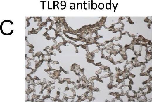 Immunocytochemistry/ Immunofluorescence TLR9 Antibody (26C593.2) - BSA Free