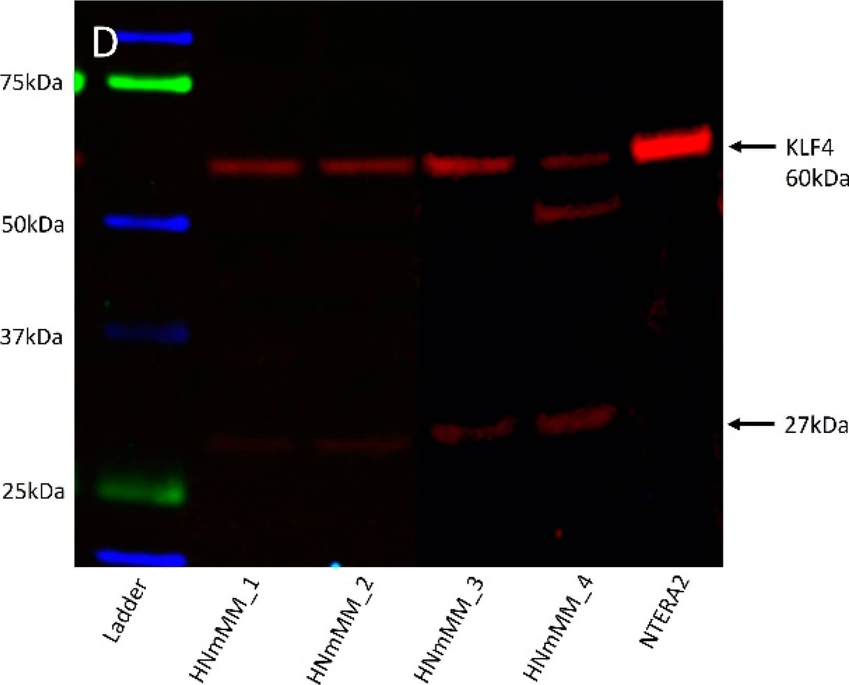 Western Blot: KLF4 Antibody [NBP2-24749] - Representative Western blot images of total protein extracted from four head & neck metastatic malignant melanoma-derived primary cell lines probed for induced pluripotent stem cell markers. Blots were probed for OCT4 (A), NANOG (B), SOX2 (C), KLF4 (D), & c-MYC (E) & detected with HRP conjugated goat anti-rabbit antibody.  alpha -Tubulin was used as the loading control (F) & detected using HRP conjugated mouse IgGĸ binding protein. Arrows indicate the presence of the proteins with their expected band sizes. Image collected & cropped by CiteAb from the following publication (//pubmed.ncbi.nlm.nih.gov/32019273), licensed under a CC-BY license. Not internally tested by Novus Biologicals.