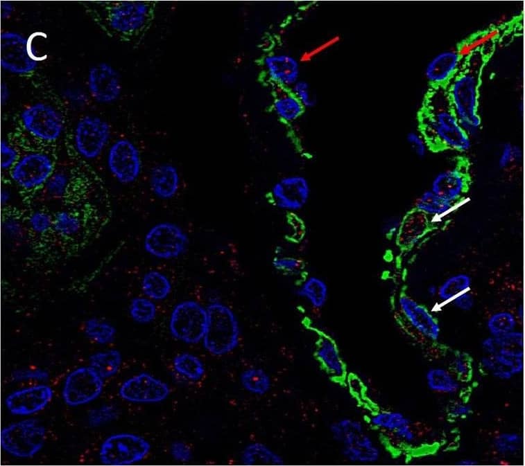 Immunohistochemistry: KLF4 Antibody [NBP2-24749] - Representative immonoflourescence immunohistochemical stained images of WHO grade I meningioma demonstrating the expression of SOX2 (A, red), NANOG (B, red), KLF4 (C, red), OCT4 (D, green) & c-MYC (E, green) on both the SMA+ (A–C, red, red arrows) pericyte layer, & the ERG+ endothelial layer (D,E, red, white arrows). Cell nuclei were counterstained with 4′, 6′-diamino-2-phenylindole (A–F), blue. Original magnification: 600X. Image collected & cropped by CiteAb from the following publication (//pubmed.ncbi.nlm.nih.gov/30417000), licensed under a CC-BY license. Not internally tested by Novus Biologicals.