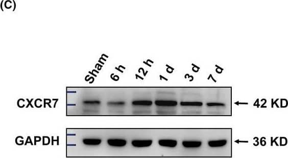 Western Blot CXCR7/RDC-1 Antibody - BSA Free