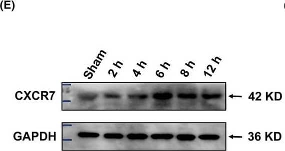 Western Blot CXCR7/RDC-1 Antibody - BSA Free