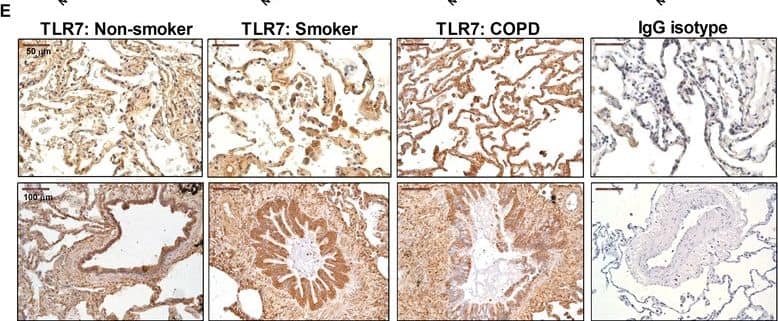 Immunohistochemistry: TLR7 Antibody - BSA Free [NBP2-24906] - Expression of TLR7 in lung tissues of non-smokers, smokers, & COPD patients. Total protein & mRNA were obtained from lung tissues of non-smokers (n = 15), smokers (n = 12), & COPD patients (n = 15). TLR7 protein & mRNA expression were determined by western blot (A) & real time PCR (B) in lung parenchyma. (A) Representative images of western blot for TLR7 & corresponding densitometry expressed as ratio to  beta -actin. (B) TLR7 mRNA expression given as the ratio to GAPDH. (C, D, E) Lung sections were immunostained for TLR7 & quantified by means of immunohistochemical score of TLR7 in alveolar macrophages (C) & bronchial epithelial cells (D). (E) Representative immunohistochemistry images are shown. The control IgG isotype showed negative staining. Data are presented as individual values & mean ± standard deviation. Exact P values were obtained using Kruskal-Wallis & Dunn’s post-hoc tests. Image collected & cropped by CiteAb from the following publication (//respiratory-research.biomedcentral.com/articles/10.1186/s12931-015-0179-5), licensed under a CC-BY license. Not internally tested by Novus Biologicals.