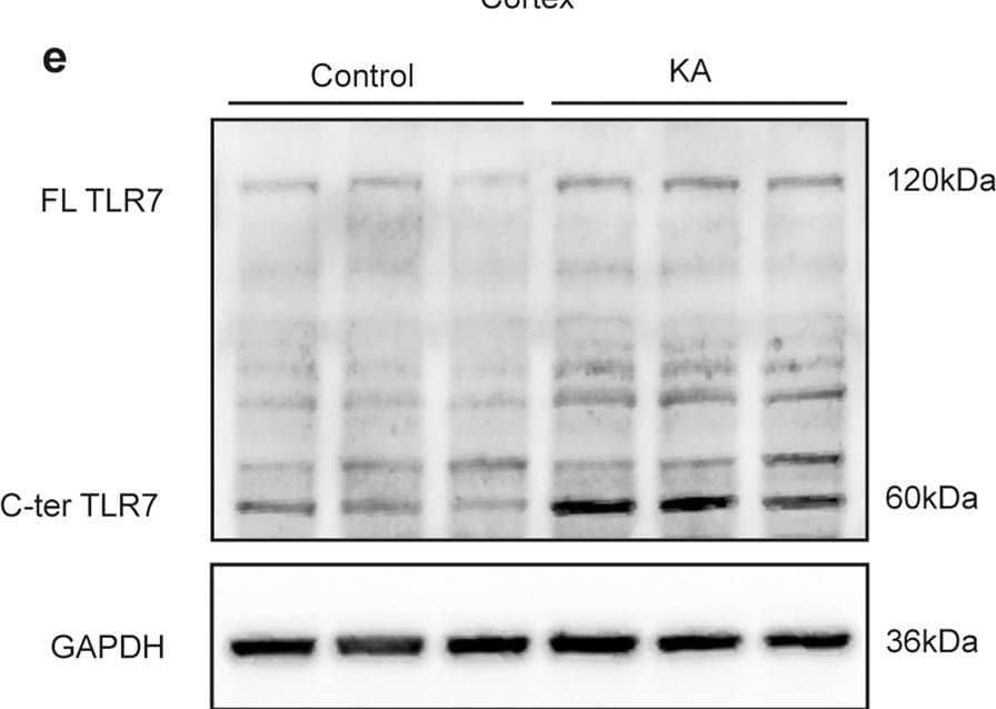 Expression of TLR7 in brain tissues at different time points after induction of status epilepticus.Quantitative real-time PCR analysis of the expression of TLR7 mRNA in the hippocampus (a) and cortex (b) at different time points after induction of SE (n = 3). ns not significant; *P < 0.05; ****P < 0.0001; one-way ANOVA with Tukey’s post hoc test. Bars represent the mean +/- SEM. The expression of FL-TLR7 and C-terminal TLR7 in the hippocampus (c, d) and temporal cortex (e, f) on the third day after induction of SE by intrahippocampal injection with KA were both significantly higher than that of the control group (n = 9 mice per group). **P < 0.01; unpaired two-tailed Student’s t-test. Bars represent the mean +/- SEM. Image collected and cropped by CiteAb from the following open publication (//pubmed.ncbi.nlm.nih.gov/37258573), licensed under a CC-BY license. Not internally tested by Novus Biologicals.