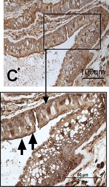 Immunohistochemistry: TLR9 Antibody (26C593.2) [PE] [NBP2-24907] - The nasal epithelium expresses TLR3, TLR7, TLR9, RIG-I & MDA-5.Sections of nasal biopsies were incubated with antibodies against TLR3 (A), TLR7 (B), TLR9 (C), RIG-I (D), & MDA-5 (E) & visualized by 3, 3′-diaminobenzidine (brown). In control slides (F), N-series universal negative control reagent was used. All sections were accompanied with a square magnification. All slides were counterstained with haematoxylin (blue). The figure shows one representative biopsy out of four (3 male, 1 female). The arrows indicate positive stained cells. Image collected & cropped by CiteAb from the following publication (//pubmed.ncbi.nlm.nih.gov/24886842), licensed under a CC-BY license. Not internally tested by Novus Biologicals.