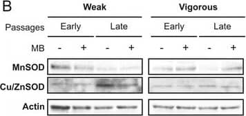 Production of superoxide radicals (O2–) and expression of antioxidant enzymes during MSC expansion, with or without methylene blue (MB) addition. a Quantification of superoxide radicals was carried out by MitoSOX staining (n = 3; values represent the mean +/- SEM). *p < 0.05. b Mitochondrial (MnSOD) and cytosolic superoxide dismutase (Cu/ZnSOD) Western blots were performed on proteins isolated from the same samples, and c results were normalized to actin Image collected and cropped by CiteAb from the following open publication (//pubmed.ncbi.nlm.nih.gov/28061861), licensed under a CC-BY license. Not internally tested by Novus Biologicals.