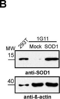 SOD1 does not affect laminin  alpha 5 expression in endothelial cells. (A) mRNA levels of human SOD1 in 1G11-mock and 1G11-SOD1 cells, as determined by RT-qPCR. Each dot represents the mean of a triplicate from an independent experiment *** p < 0.001; two-tailed t-test. (B) Human SOD1 protein levels in 1G11-mock and 1G11-SOD1 cells as determined by immunoblotting; HEK-293T cells were used as a human SOD1 reference. Immunoblots were rehybridized with an anti-beta -actin antibody as a loading control. A representative experiment is shown. (C) 1G11-mock and 1G11-SOD1 cells were incubated (14 h) with the conditioned medium from N202.1A tumor cell line cultures (MCT) and then stained with DHE (red); nuclei were DAPI-counterstained (blue). Treatment with the SOD mimetic MnTBAP was used as control (right panels). Scale bars 25 um. (D) SOD activity in 1G11-mock and 1G11-SOD1 cell extracts. (E) Relative LAMA5 mRNA levels in 1G11-mock and 1G11-SOD1 cells. Each dot represents the mean of a triplicate from an independent experiment (n = 5). p = 0.32, two-tailed t-test. (F) Representative images of laminin  alpha 5 (green; PAC078MV01) staining in 1G11-mock and 1G11-SOD1 cells; nuclei were DAPI counterstained (blue). Scale bars 50 um. (G) Quantification of laminin  alpha 5 mean fluorescence intensity from the images as in (F) (n = 5 fields/condition). p = 0.58; two-tailed t-test. (H) Relative LAMA4 mRNA levels in 1G11-mock, 1G11-SOD3 and 1G11-SOD1 cells. Each dot represents the mean of a triplicate from an independent experiment (n = 6). ** p < 0.01, *** p < 0.001, two-tailed t-test. Image collected and cropped by CiteAb from the following open publication (//pubmed.ncbi.nlm.nih.gov/35267534), licensed under a CC-BY license. Not internally tested by Novus Biologicals.