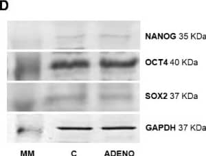 Protein expression of NANOG a, OCT4 b & SOX2 c in bovine uterine tissues obtained from control cows & from cows with adenomyosis. Data were normalized against glyceraldehyde-3-phosphate dehydrogenase (GAPDH). Bars represent the mean ± SEM. There were no statistical differences between uterine normal & adenomyotic tissues (P > 0.05), as determined by Student’s t-test. Representative blots for NANOG, OCT4, SOX2 & GAPDH are shown below the graphs d. MM – molecular weight marker, C – tissues obtained from control cows, ADENO – tissues obtained from cows with adenomyosis Image collected & cropped by CiteAb from the following publication (//www.rbej.com/content/13/1/110), licensed under a CC-BY license. Not internally tested by Novus Biologicals.