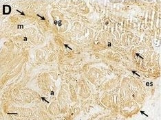 Immunohistochemistry: Nanog Antibody [NBP2-24941] - Immunodetection of pluripotency markers in uterine tissues from control cows & from cows with adenomyosis. a, b – haematoxylin & eosin stained slides of control & adenomyotic uterus, respectively; c, d – NANOG immunodetection in control & adenomyotic tissue, respectively; e, f – immunolocalisation of OCT4 in normal & adenomyotic tissue, respectively; g, h – SOX2 immunodetection in control & adenomyotic tissue, respectively; i, j, k – no Ab, negative controls for NANOG, OCT4 & SOX2, respectively. Unspecific IgG controls (pictures not shown) served similar pictures as no Ab control. Arrows indicate the most intense histochemical reactions; dotted line indicate endometrial-myometrial border; e – endometrium, m – myometrium, es – endometrial stroma, eg – endometrial gland, a – adenomyotic lesion, v – vessel. Scale bars: 20 μm Image collected & cropped by CiteAb from the following publication (//www.rbej.com/content/13/1/110), licensed under a CC-BY license. Not internally tested by Novus Biologicals.