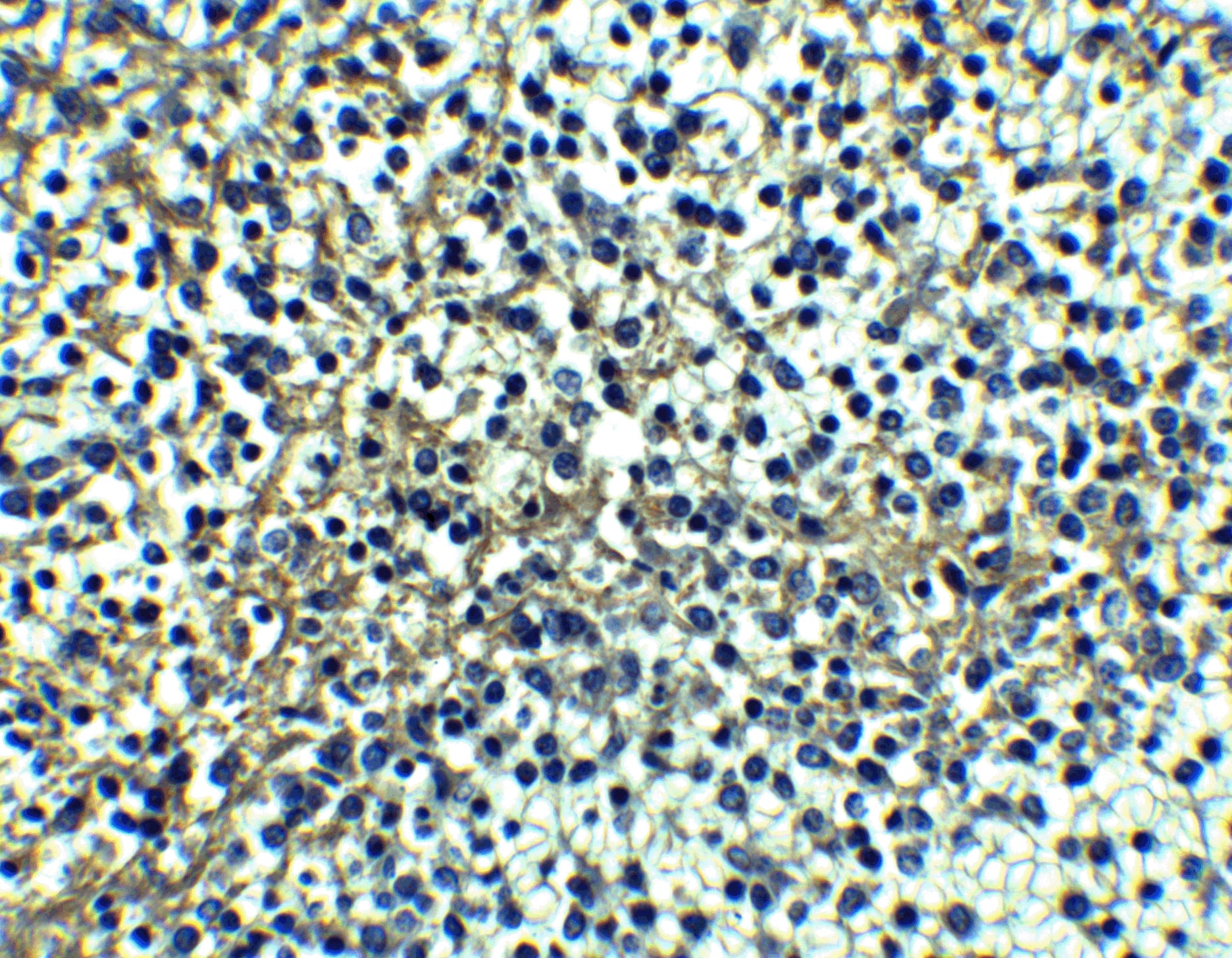 Immunohistochemistry: TRAILR1/TNFRSF10A Antibody - BSA Free [NBP2-25092] - Validation of TRAILR1/TNFRSF10A Immunohistochemical analysis of paraffin-embedded human spleen tissue using anti-TRAILR1/TNFRSF10A antibody  at 10 u/ml. Tissue was fixed with formaldehyde and blocked with 10% serum for 1 h at RT; antigen retrieval was by heat mediation with a citrate buffer (pH6). Samples were incubated with primary antibody overnight at 4μC. A goat anti-rabbit IgG H&L (HRP) at 1/250 was used as secondary. Counter stained with Hematoxylin.