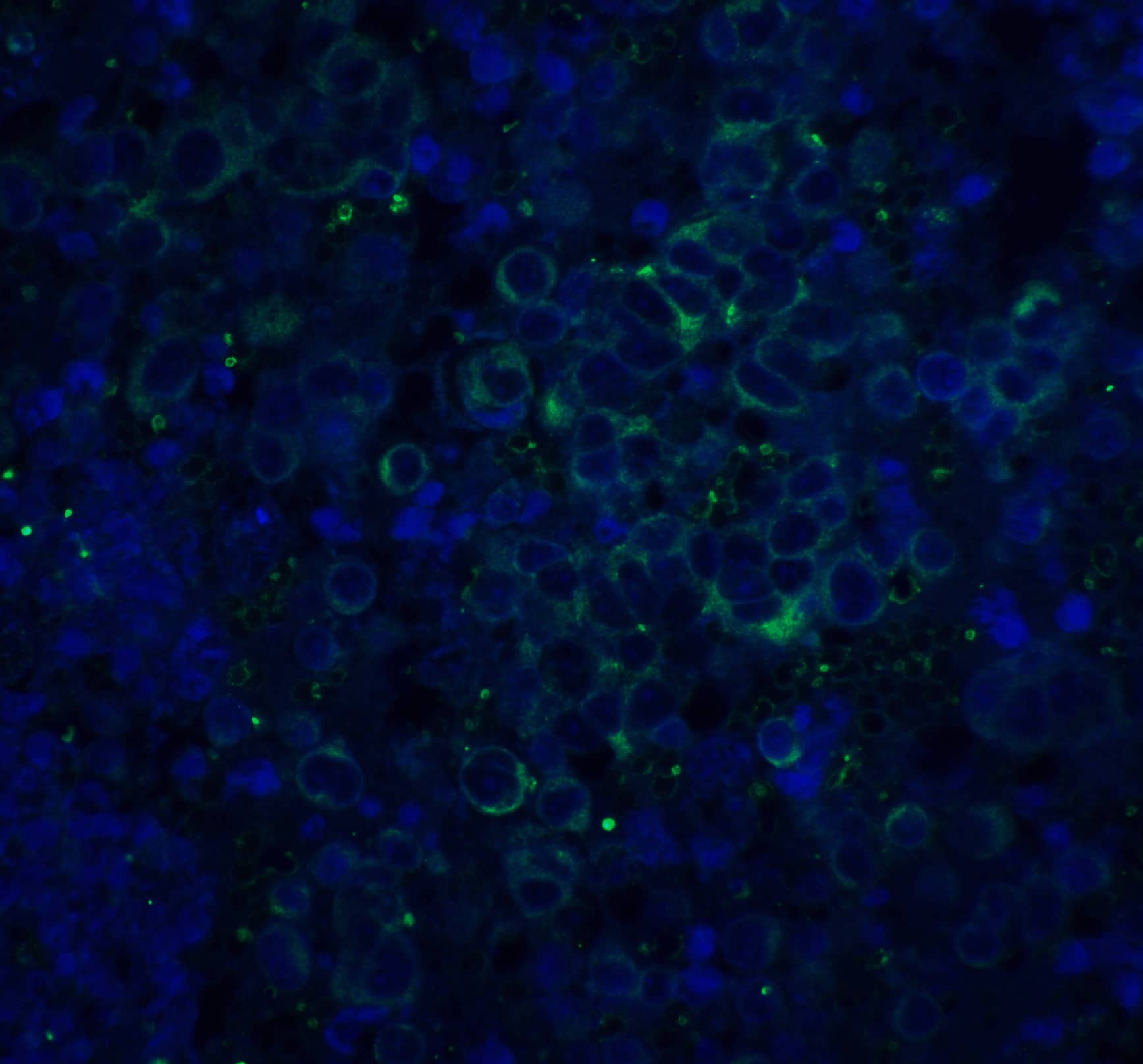 Immunohistochemistry: beta Amyloid Antibody - BSA Free [NBP2-25093] - Immunofluorescence of ASAH1 in rat heart tissue with ASAH1 antibody at 20 ug/mL.Green: beta Amyloid Antibody   Blue: DAPI staining