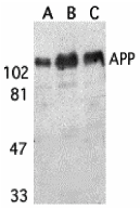 Western Blot: beta Amyloid Antibody - BSA Free [NBP2-25093] - Western blot analysis of beta Amyloid in (A) human, (B) mouse, and (C) rat brain tissue lysates with beta Amyloid antibody at 1 ug/mL. 